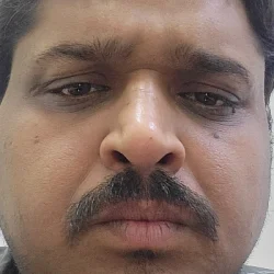 Nitesh Goyal